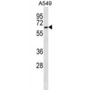 Pre-mRNA Processing Factor 31 (PRPF31) Antibody