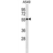 Semenogelin I (SEMG1) Antibody