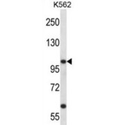 Potassium Voltage-Gated Channel Subfamily C Member 3 (KCNC3) Antibody