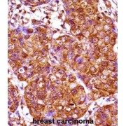 Iroquois Homeobox 3 (IRX3) Antibody