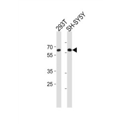 Iroquois Homeobox 3 (IRX3) Antibody