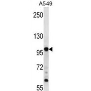 Targeting Protein For Xklp2 (TPX2) Antibody