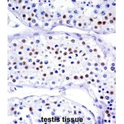 Ubiquitin Like Modifier Activating Enzyme 1 (UBA1) Antibody