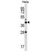 RAD23 Homolog A, Nucleotide Excision Repair Protein (RAD23A) Antibody
