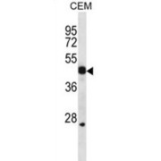 Wnt Inhibitory Factor 1 (WIF1) Antibody