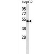 Farnesyl Diphosphate Farnesyltransferase 1 (FDFT1) Antibody