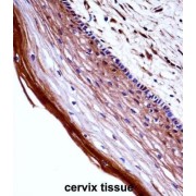 Placenta Growth Factor (PGF) Antibody