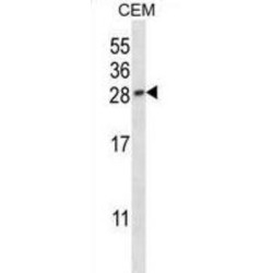 Placenta Growth Factor (PGF) Antibody