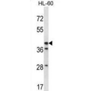 3 Beta-Hydroxysteroid Dehydrogenase/Delta 5-->4-Isomerase Type 1 (HSD3B1) Antibody