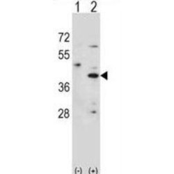 3 Beta-Hydroxysteroid Dehydrogenase/Delta 5-->4-Isomerase Type 1 (HSD3B1) Antibody