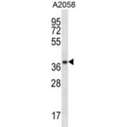 Proteasome Subunit Alpha Type 1 (PSMA1) Antibody