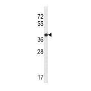 P2Y Purinoceptor 1 (P2RY1) Antibody