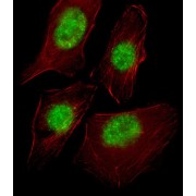 TATA-Box Binding Protein Associated Factor 9 (TAF9) Antibody