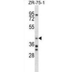 Aryl Hydrocarbon Receptor Interacting Protein (AIP) Antibody