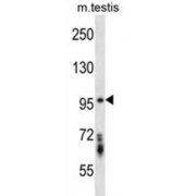Serine/threonine-Protein Kinase STK10 (Stk10) Antibody