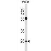 Mediator Complex Subunit 6 (MED6) Antibody