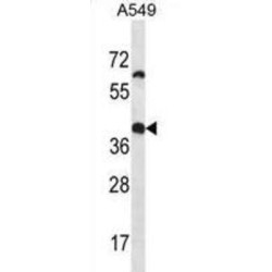 Olfactory Receptor Family 14 Subfamily J Member 1 (OR14J1) Antibody