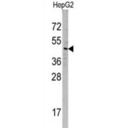 Sorting Nexin 6 (SNX6) Antibody