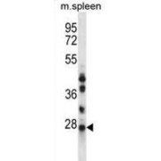 N-Ribosyldihydronicotinamide:Quinone Reductase 2 (NQO2) Antibody