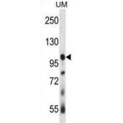 Ubiquitin Specific Peptidase 4 (USP4) Antibody