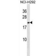 High Mobility Group Protein B3 (HMGB3) Antibody