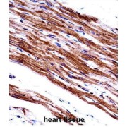 Myosin Light Chain 9, Regulatory (MYL9) Antibody
