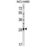 Interleukin 17D (IL17D) Antibody