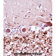 Fanconi Anemia Group G Protein (FANCG) Antibody