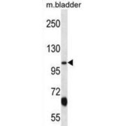 Potassium Voltage-Gated Channel Subfamily KQT Member 3 (KCNQ3) Antibody