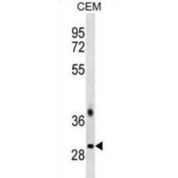 Transformer-2 Protein Homolog Beta (TRA2B) Antibody