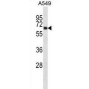 Potassium Voltage-Gated Channel Subfamily A Member 3 (KCNA3) Antibody