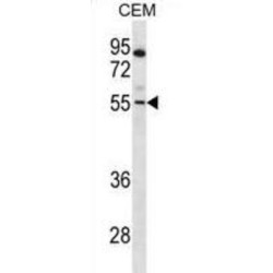 Paired Box Protein Pax-7 (PAX7) Antibody