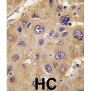 Methylmalonate-Semialdehyde Dehydrogenase [acylating], Mitochondrial (ALDH6A1) Antibody