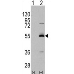 Methylmalonate-Semialdehyde Dehydrogenase [acylating], Mitochondrial (ALDH6A1) Antibody