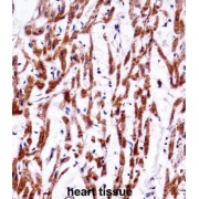 Transmembrane Protein 85 (TMM85) Antibody