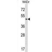 Ankyrin Repeat And SAM Domain-Containing Protein 4B (ANKS4B) Antibody