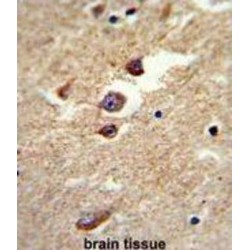 Aldehyde Dehydrogenase 5 Family Member A1 (ALDH5A1) Antibody