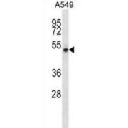 NudC Domain-Containing Protein 1 (NUDCD1) Antibody