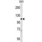 DNA-Directed RNA Polymerase II Subunit RPB2 (POLR2B) Antibody