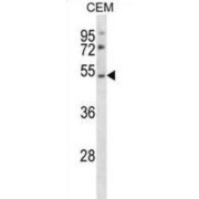 P2Y Purinoceptor 2 (P2RY2) Antibody