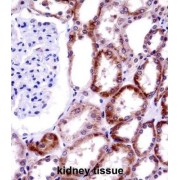 CD70 Antigen / TNFSF7 (CD70) Antibody