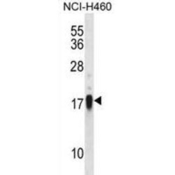 CD70 Antigen / TNFSF7 (CD70) Antibody