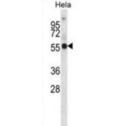 Potassium Voltage-Gated Channel Subfamily A Member 1 (KCNA1) Antibody