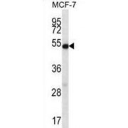 Coilin (COIL) Antibody