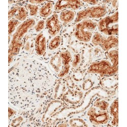 Alkaline Phosphatase, Tissue-Nonspecific Isozyme (ALPL) Antibody