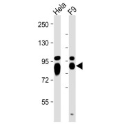 Western blot analysis of HeLa (Lane 1) and F9 (Lane 2) cell lysates (20 µg/lane) using Alkaline Phosphatase, Tissue-Nonspecific Isozyme (ALPL) Antibody (1/2000 dilution) followed by HRP-conjugated Goat Anti-Rabbit IgG, H+L secondary antibody (1/10000 dilution). Blocking/dilution buffer: 5% NFDM/TBST.