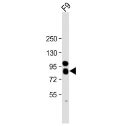 Alkaline Phosphatase, Tissue-Nonspecific Isozyme (ALPL) Antibody