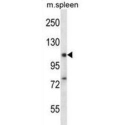 RNA-Binding Protein 12 (RBM12) Antibody