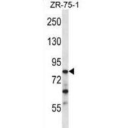 CCR4-NOT Transcription Complex Subunit 3 (CNOT3) Antibody