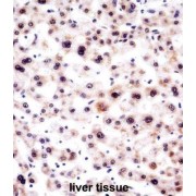 U1 Small Nuclear Ribonucleoprotein A (SNRPA) Antibody